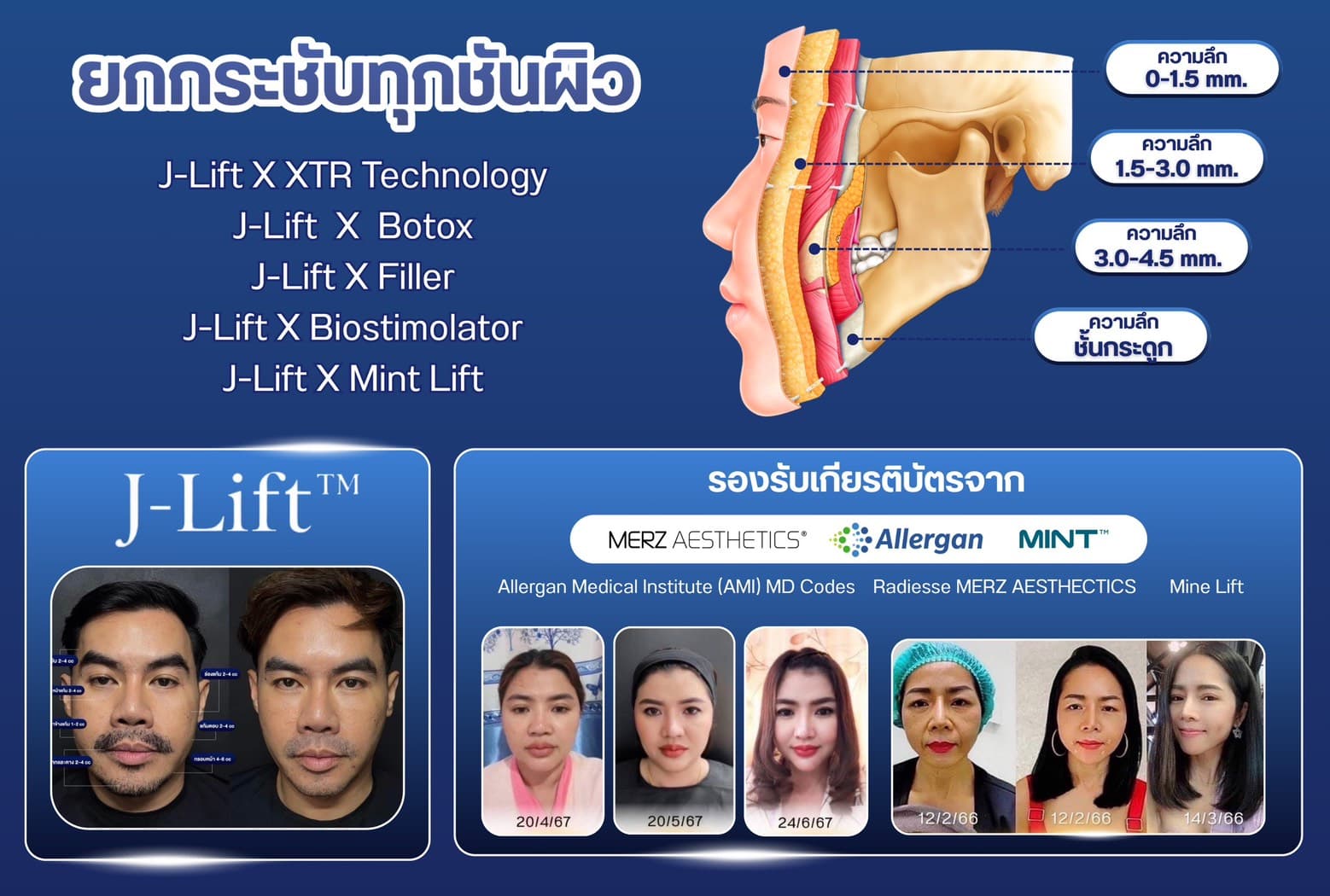ยกกระชับใบหน้าโดยไม่ต้องผ่าตัด Dr. J Clinic | คืนความอ่อนเยาว์ให้ผิวคุณอย่างปลอดภัย